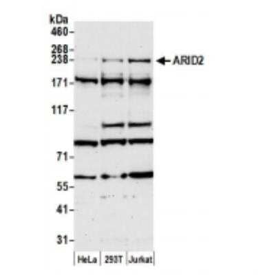 Western Blot: ARID2 Antibody [NBP1-26615]