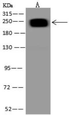 Western Blot: ARID2 Antibody [NBP3-12715]