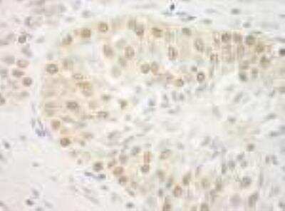 Immunohistochemistry: ARID3B Antibody [NBP1-30456]