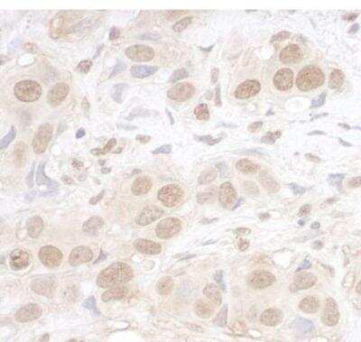 Immunohistochemistry-Paraffin: ARID3B Antibody [NBP1-30456]