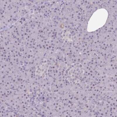 Immunohistochemistry-Paraffin: ARID3B Antibody [NBP2-33596]