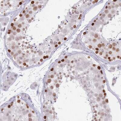 Immunohistochemistry-Paraffin: ARID3B Antibody [NBP2-33596]