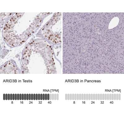 Immunohistochemistry-Paraffin: ARID3B Antibody [NBP2-33596]