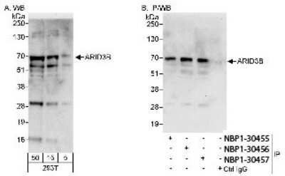 Western Blot: ARID3B Antibody [NBP1-30457]