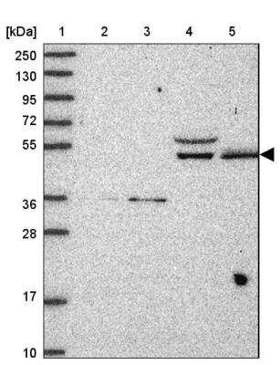 Western Blot: ARID3B Antibody [NBP2-33596]