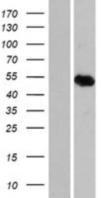 Western Blot: ARID3C Overexpression Lysate [NBP2-08662]