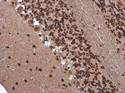 Immunohistochemistry-Paraffin: ARID5A Antibody (1683) [NBP2-43676]