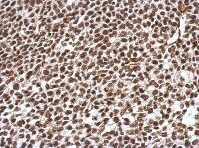 Immunohistochemistry-Paraffin: ARID5A Antibody [NBP2-15459]