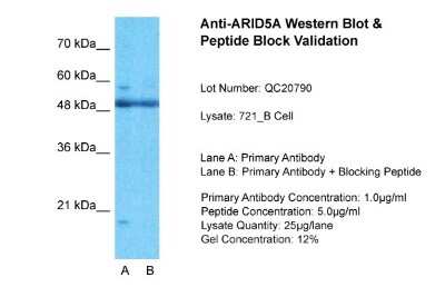 Western Blot: ARID5A Antibody [NBP1-79440]