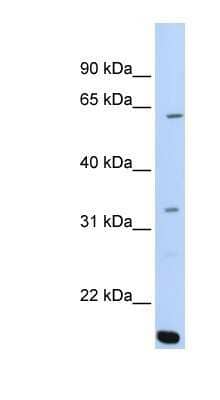 Western Blot: ARID5A Antibody [NBP1-79441]