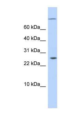 Western Blot: ARID5A Antibody [NBP1-79452]