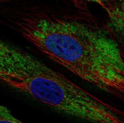 Immunocytochemistry/ Immunofluorescence: ARID5B Antibody [NBP1-83622]