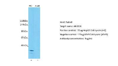 Western Blot: ARID5B Antibody [NBP2-87039]