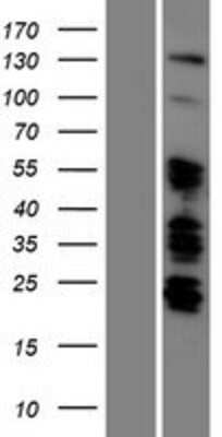 Western Blot: ARID5B Overexpression Lysate [NBP2-06062]