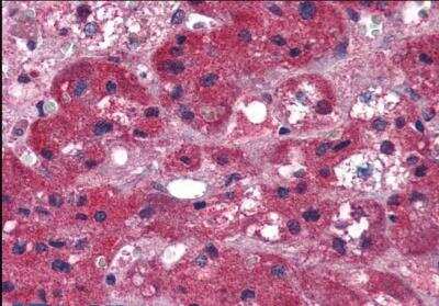 Immunohistochemistry-Paraffin: ARIH1 Antibody [NB100-1162]