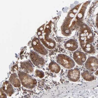 Immunohistochemistry-Paraffin: ARIH1 Antibody [NBP1-88984]