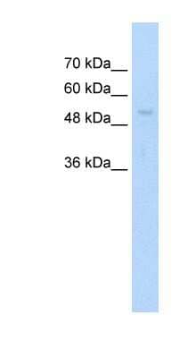 Western Blot: ARIH1 Antibody [NBP1-55039]