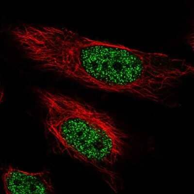 Immunocytochemistry/ Immunofluorescence: ARIH2 Antibody [NBP2-57159]