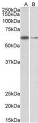 Western Blot: ARIH2 Antibody [NB100-1163]