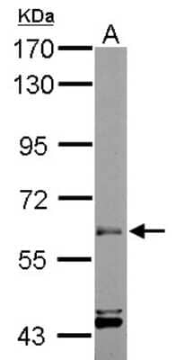 Western Blot: ARIH2 Antibody [NBP1-31044]