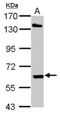 Western Blot: ARIH2 Antibody [NBP1-31044]