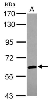 Western Blot: ARIH2 Antibody [NBP2-15460]