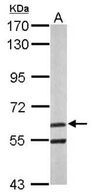 Western Blot: ARIH2 Antibody [NBP2-15460]