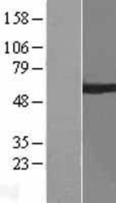 Western Blot: ARIH2 Overexpression Lysate [NBL1-07686]