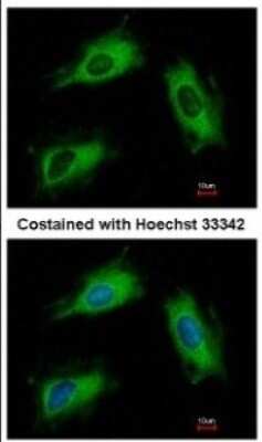 Immunocytochemistry/ Immunofluorescence: ARL1 Antibody [NBP2-15461]