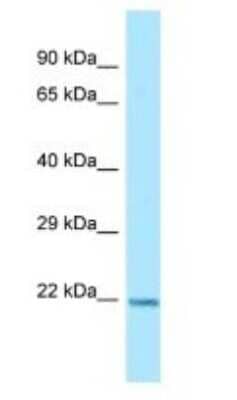 Western Blot: ARL1 Antibody [NBP1-98484]