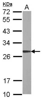 Western Blot: ARL1 Antibody [NBP2-15461]