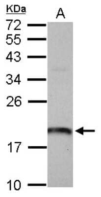 Western Blot: ARL1 Antibody [NBP2-15462]