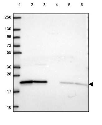 Western Blot: ARL1 Antibody [NBP2-49680]