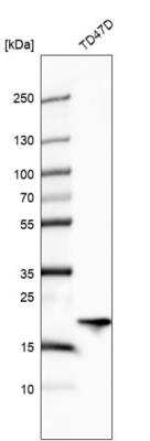 Western Blot: ARL1 Antibody [NBP2-57579]