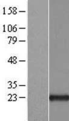 Western Blot: ARL1 Overexpression Lysate [NBL1-07687]