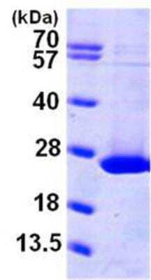 SDS-PAGE: Recombinant Human ARL1 His Protein [NBP1-45312]