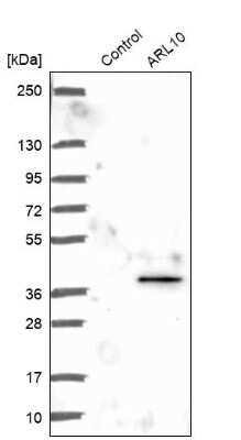 Western Blot: ARL10 Antibody [NBP2-14311]