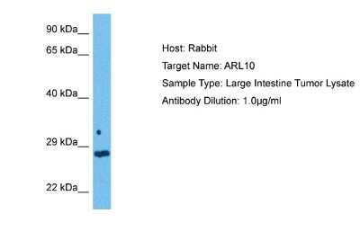 Western Blot: ARL10 Antibody [NBP2-84457]