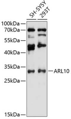 Western Blot: ARL10 AntibodyAzide and BSA Free [NBP2-92089]