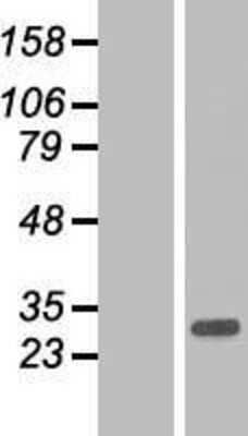 Western Blot: ARL10 Overexpression Lysate [NBP2-05130]