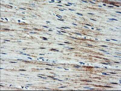Immunohistochemistry-Paraffin: ARL11 Antibody (OTI1A5) [NBP2-01470]