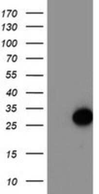 Western Blot: ARL11 Antibody (OTI1A5) [NBP2-01470]