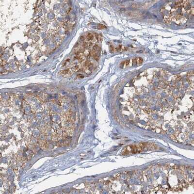 Immunohistochemistry-Paraffin: ARL11 Antibody [NBP1-88990]
