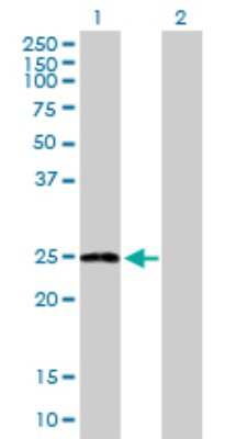 Western Blot: ARL11 Antibody [H00115761-B01P]