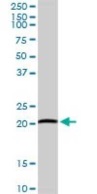 Western Blot: ARL11 Antibody [H00115761-D01P]