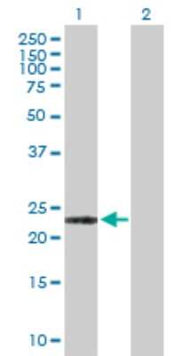 Western Blot: ARL11 Antibody [H00115761-D01P]