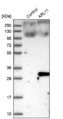 Western Blot: ARL11 Antibody [NBP1-88990]