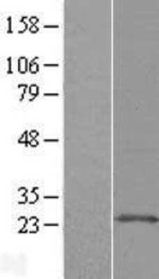 Western Blot: ARL11 Overexpression Lysate [NBL1-07688]