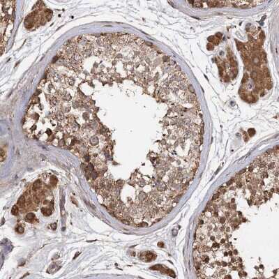 Immunohistochemistry: ARL13A Antibody [NBP2-32681]