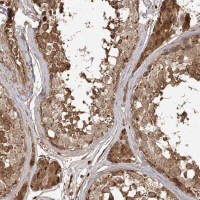 Immunohistochemistry-Paraffin: ARL13A Antibody [NBP1-90844]